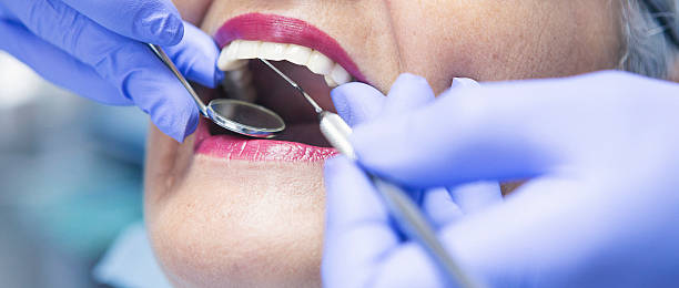 Best Emergency Dentist for Lost Fillings or Crowns in Scappoose, OR